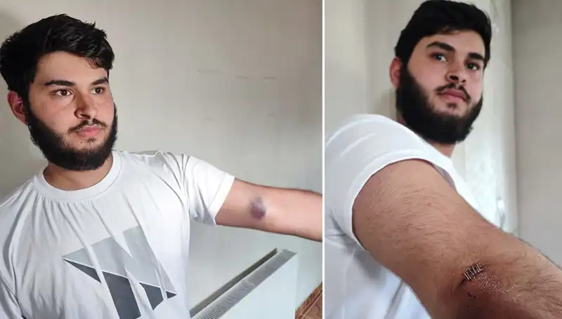 Mahallede Şok: Bahçeye Kaçan Top, Conoları Kamyonetle Getirdi
