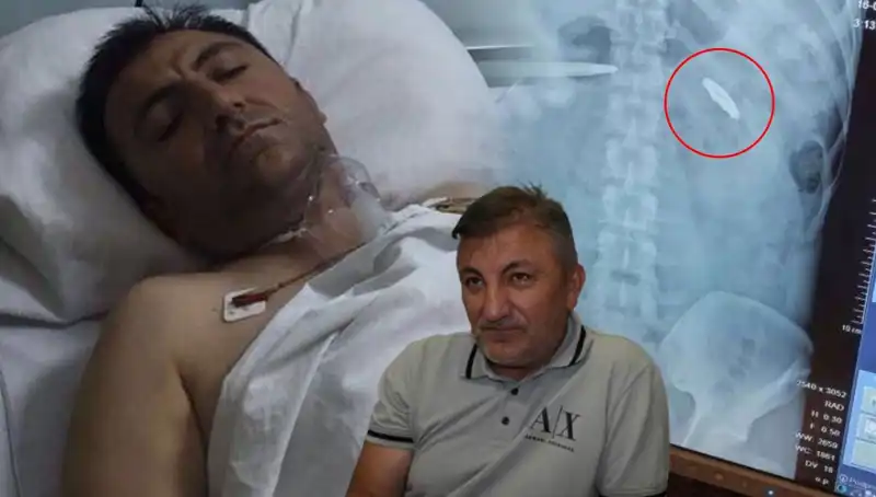 15 Temmuz’un İhlali: Vücudunda Kurşunla Taşıdığı 9 Yıllık Acı
