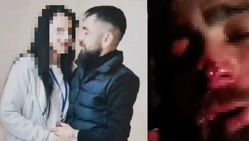 Eski Sevgiliye Uğradığı Şiddet: Abisi Tarafından Kulağı ve Burnu Koparıldı